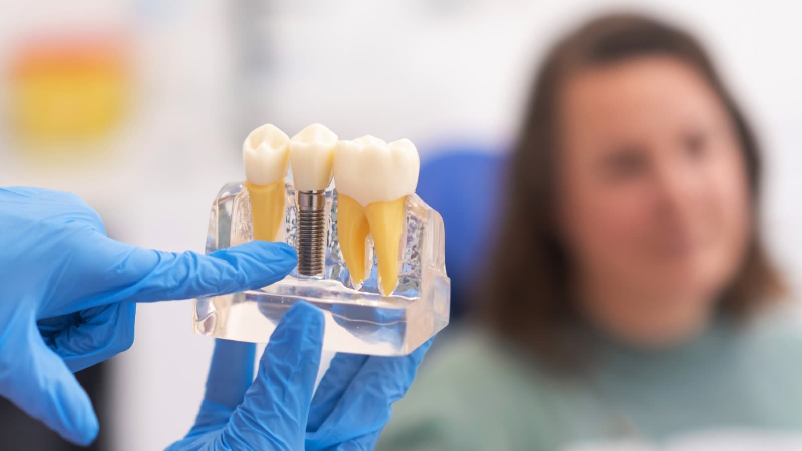Dental implant restoration illustration